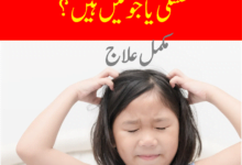 How to Remove Lice from Hair Permanently - Ubqari Totkay for Lice