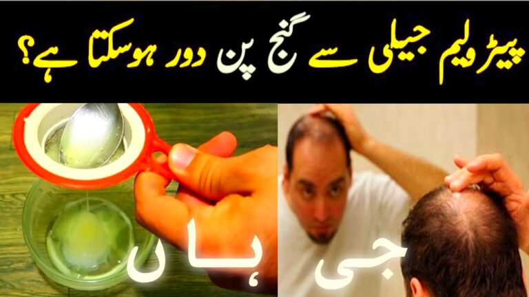 Get Rid of Baldness with Petroleum Jelly Urdu Totkay